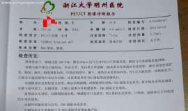 前列腺癌肺转骨转